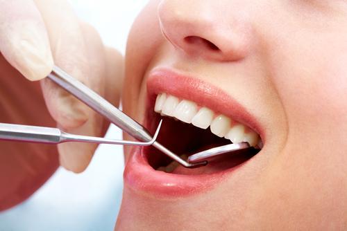 Dental Check-UP / Consultation